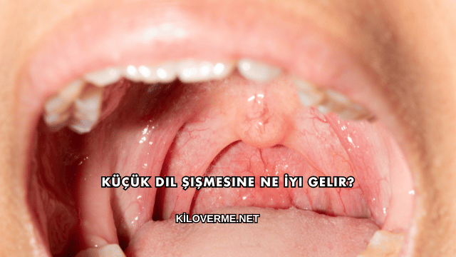 Küçük Dil Şişmesine Ne İyi Gelir?