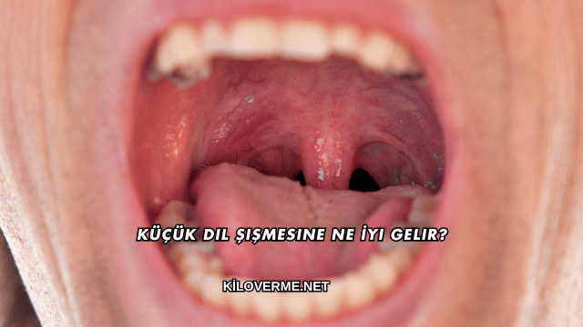 Küçük Dil Şişmesine Ne İyi Gelir?