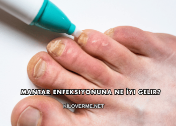 Mantar Enfeksiyonuna Ne İyi Gelir?