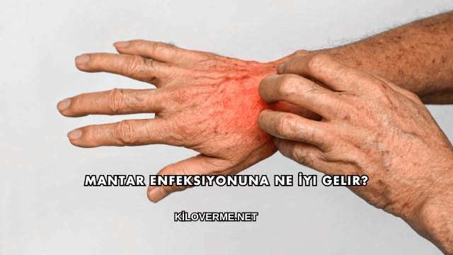 Mantar Enfeksiyonuna Ne İyi Gelir?