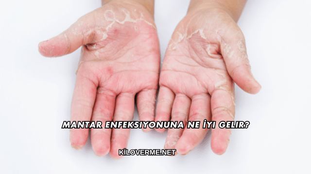 Mantar Enfeksiyonuna Ne İyi Gelir?
