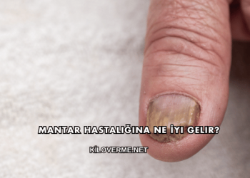 Mantar Hastalığına Ne İyi Gelir?