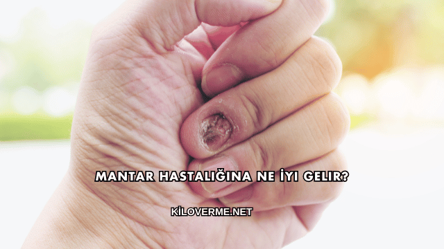 Mantar Hastalığına Ne İyi Gelir?