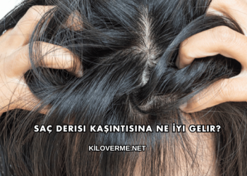 Saç Derisi Kaşıntısına Ne İyi Gelir?