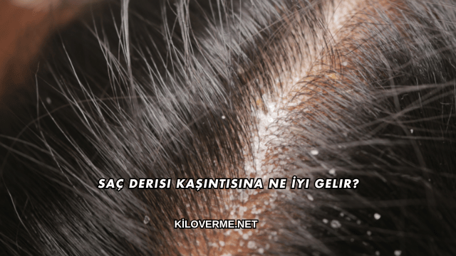 Saç Derisi Kaşıntısına Ne İyi Gelir?