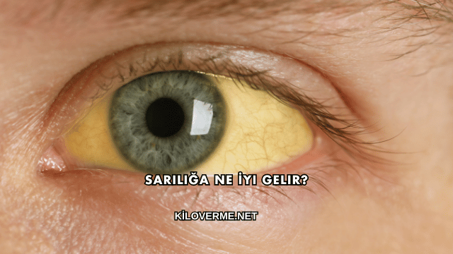 Sarılığa Ne İyi Gelir?