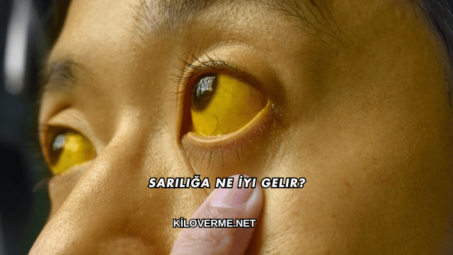 Sarılığa Ne İyi Gelir?