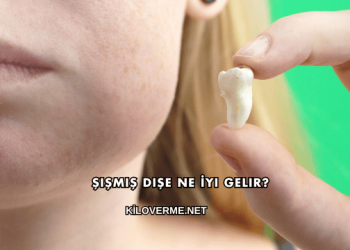 Şişmiş Dişe Ne İyi Gelir?