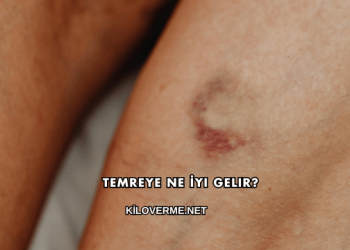 Temreye Ne İyi Gelir?