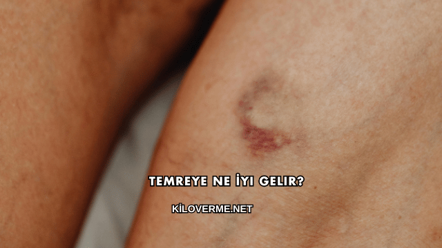 Temreye Ne İyi Gelir?