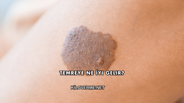 Temreye Ne İyi Gelir?