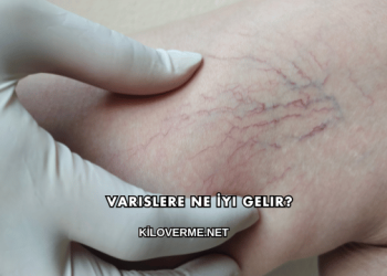 Varislere Ne İyi Gelir?