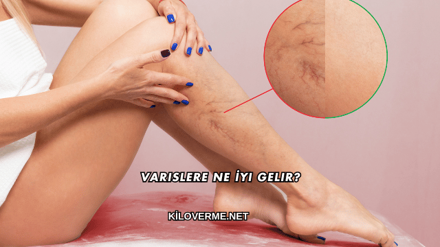 Varislere Ne İyi Gelir?