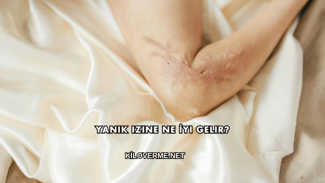 Yanık Izine Ne İyi Gelir?