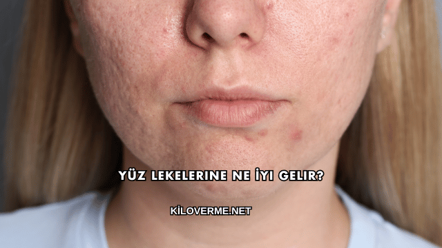 Yüz Lekelerine Ne İyi Gelir?