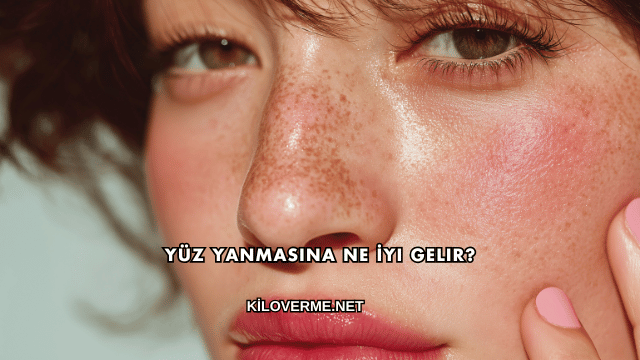 Yüz Yanmasına Ne İyi Gelir?