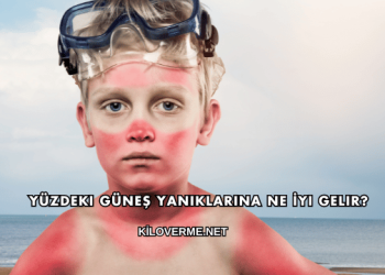Yüzdeki Güneş Yanıklarına Ne İyi Gelir?