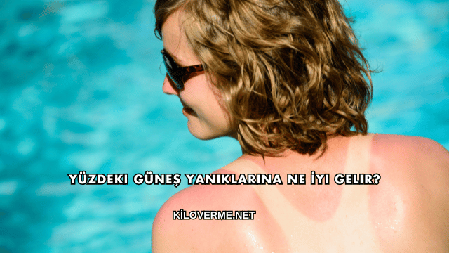 Yüzdeki Güneş Yanıklarına Ne İyi Gelir?