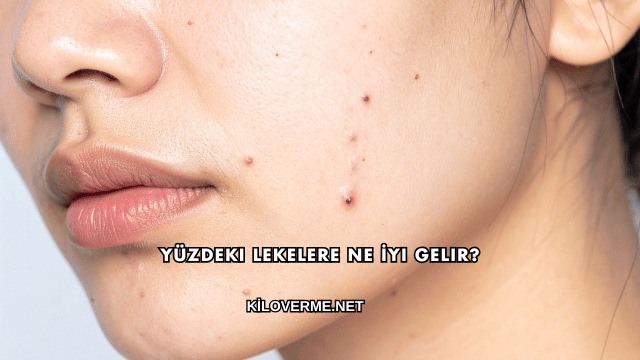 Yüzdeki Lekelere Ne İyi Gelir?