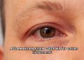 Ağlamaktan Şişen Göze Ne İyi Gelir?