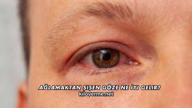 Ağlamaktan Şişen Göze Ne İyi Gelir?