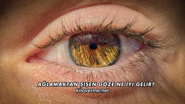 Ağlamaktan Şişen Göze Ne İyi Gelir?