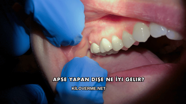 Apse Yapan Dişe Ne İyi Gelir?