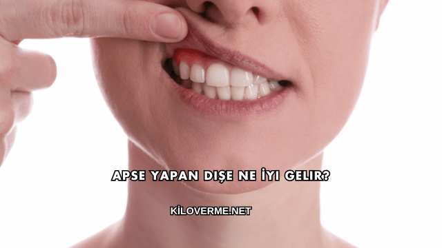 Apse Yapan Dişe Ne İyi Gelir?