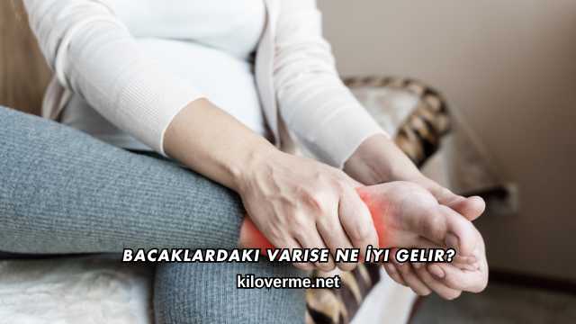Bacaklardaki Varise Ne İyi Gelir?