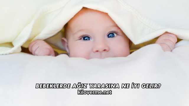 Bebeklerde Ağız Yarasına Ne İyi Gelir?