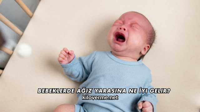 Bebeklerde Ağız Yarasına Ne İyi Gelir?