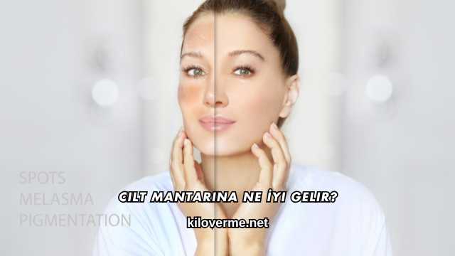 Cilt Mantarına Ne İyi Gelir?