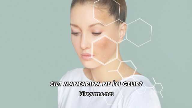 Cilt Mantarına Ne İyi Gelir?