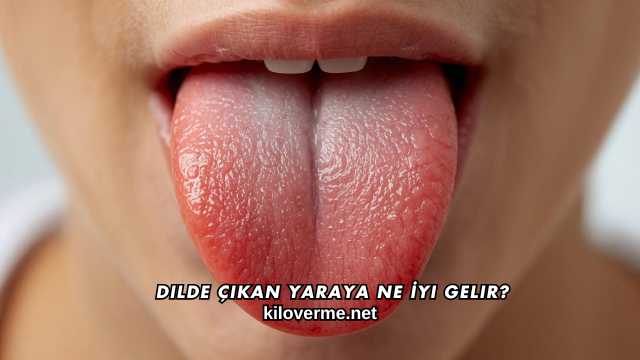 Dilde Çıkan Yaraya Ne İyi Gelir?