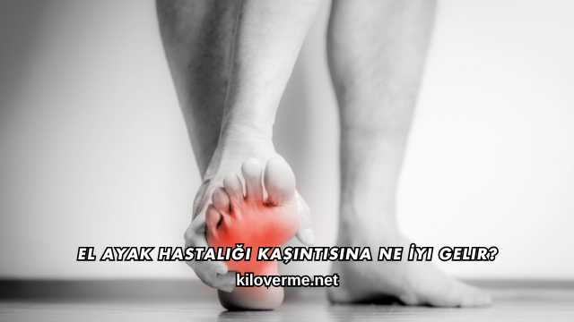 El Ayak Hastalığı Kaşıntısına Ne İyi Gelir?