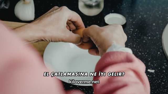 El Çatlamasına Ne İyi Gelir?