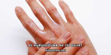 El Kuruluğuna Ne İyi Gelir?