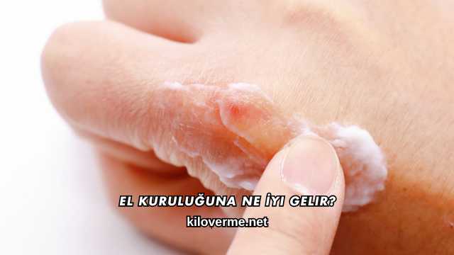 El Kuruluğuna Ne İyi Gelir?