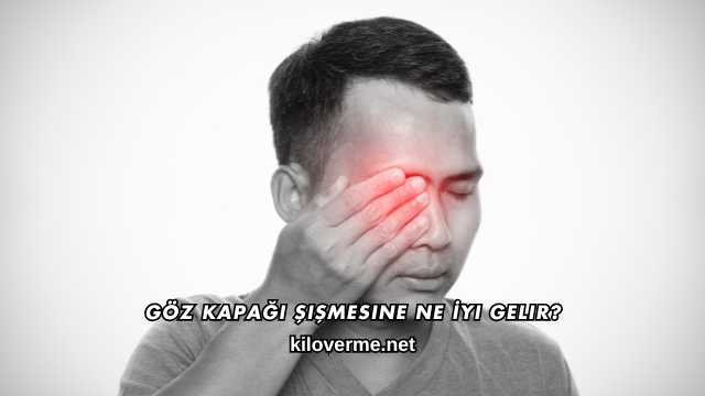 Göz Kapağı Şişmesine Ne İyi Gelir