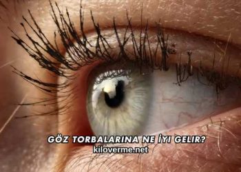 Göz Torbalarına Ne İyi Gelir?