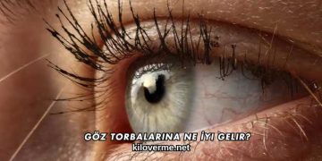 Göz Torbalarına Ne İyi Gelir?