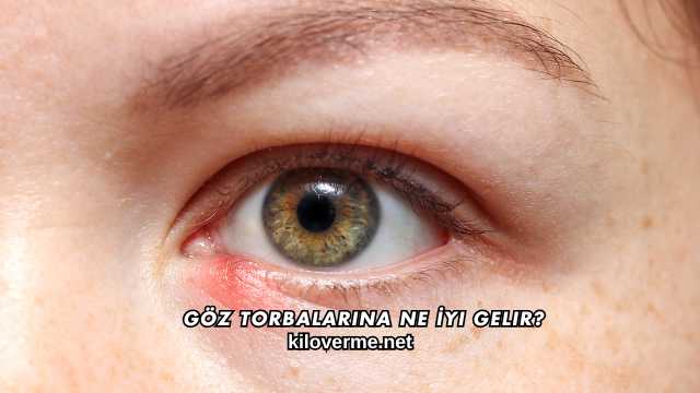 Göz Torbalarına Ne İyi Gelir?