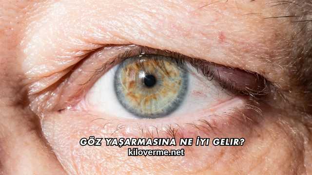 Göz Yaşarmasına Ne İyi Gelir?