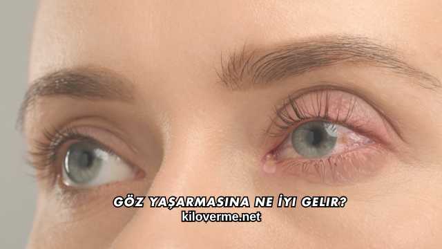Göz Yaşarmasına Ne İyi Gelir?