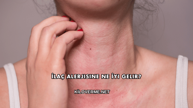 İlaç Alerjisine Ne İyi Gelir?