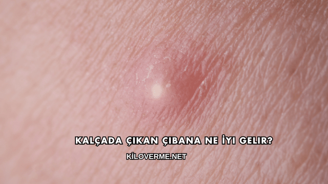 Kalçada Çıkan Çıbana Ne İyi Gelir?