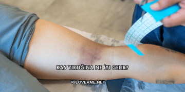 Kas Yırtığına Ne İyi Gelir?