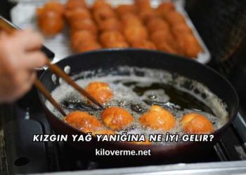 Kızgın Yağ Yanığına Ne İyi Gelir?