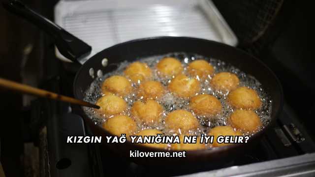 Kızgın Yağ Yanığına Ne İyi Gelir?