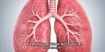 Koah Hastalığına Ne İyi Gelir?